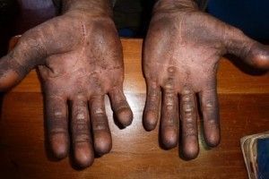 17 trabalhadores forreduzidos à condições