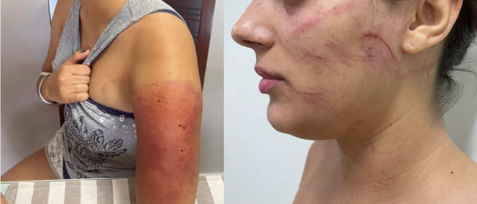 Isabella - agressão 2